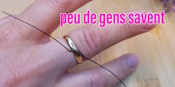 Un médecin m&rsquo;a montré comment enlever la bague coincée sur mon doigt