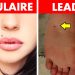 Ce que disent les grains de beauté à différents endroits de votre corps