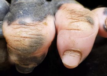 Une photo de gorille présentant un manque de pigmentation montre une main qui ressemble de manière frappante à celle d&rsquo;un humain
