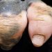 Une photo de gorille présentant un manque de pigmentation montre une main qui ressemble de manière frappante à celle d&rsquo;un humain