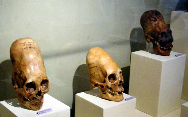Ces crânes sont exposés au Museo Regional de Ica, dans la ville d'Ica, au Pérou © Wikimedia Commons