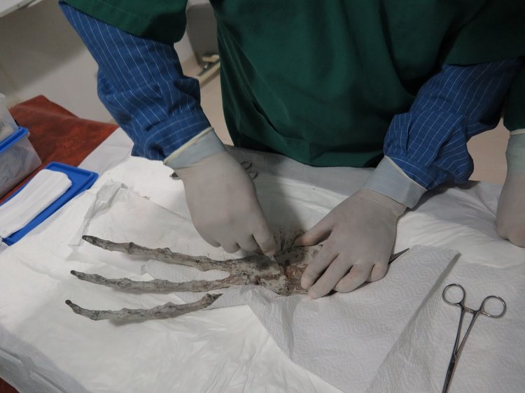 Momie de Nazca. Main tridactyle.
