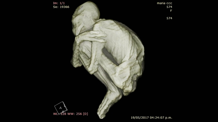 Vue en 3D d'une tomographie montrant la structure squelettique complète de la momie nommée Maria, dans une position fœtale.