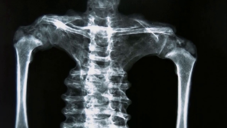 Radiographie montrant la structure osseuse du torse et des membres, utilisée par les experts pour analyser l'anatomie non humaine.
